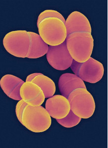 Lactococcus lactis (300...