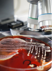 Microbial Challenge Test