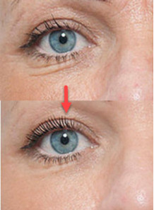 FoundationFix™ (Wrinkle...