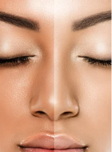 GentiWhite™ (Methyl Gentisate)