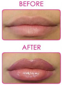 InstantPlump™ (Lip Plumper)