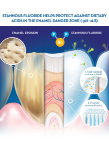 Stannous Fluoride (SnF2,...